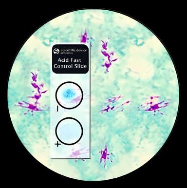 Acid Fast Stain Positive/Negative Control Slide Set for Microbial Identification