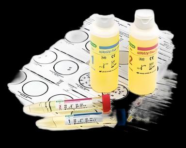 Reproductive Endocrinology Control Set qUAntify® Plus Pregnancy (hCG) Rapid Testing 2 Levels 10 X 12 mL