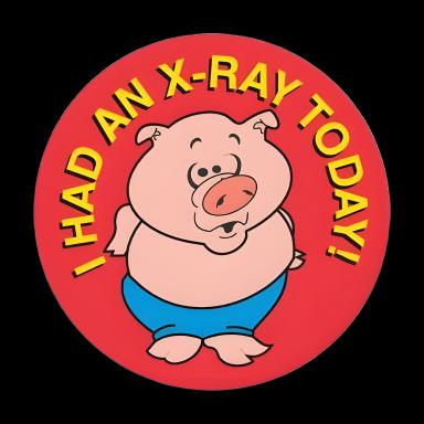 PDC® 2-Inch 'I Had a X-Ray Today' Reward Sticker for Pediatric Patients
