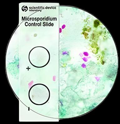 Mycology Control Set with Microsporidia: Positive/Negative Slides