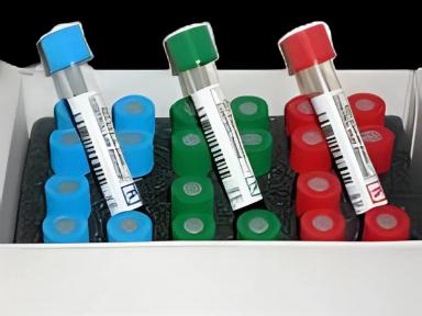 Hematology Control Set EX-TROL® Whole Blood Hematology Low Level / Normal Level / High Level 6 X 3 X 4.5 mL