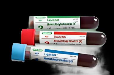 Hematology Control Set E-Check™ XS CBC / DIFF Normal Level / High Level 5 X 2 X 1.5 mL