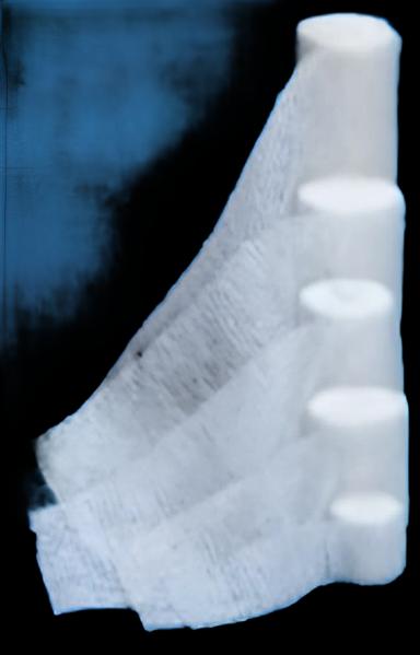 Conforming Bandage Apex™ 2 X 65 Inch 12 per Pack Sterile 1-Ply Roll Shape